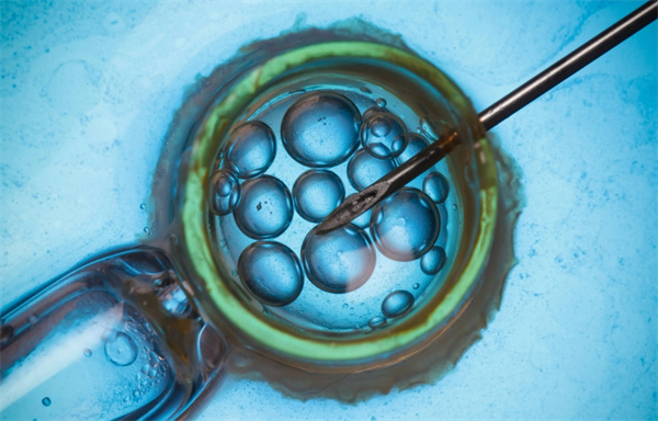 柬埔寨的私人机构做试管婴儿靠不靠谱看这几点