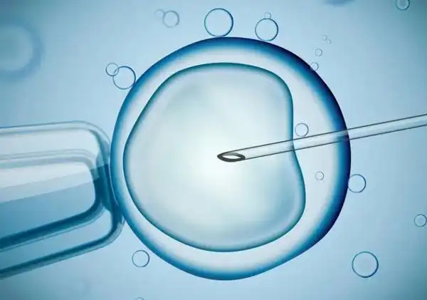 柬埔寨哪家机构做三代试管婴儿比较靠谱